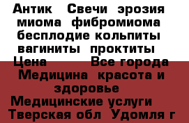 Антик.  Свечи (эрозия, миома, фибромиома, бесплодие,кольпиты, вагиниты, проктиты › Цена ­ 550 - Все города Медицина, красота и здоровье » Медицинские услуги   . Тверская обл.,Удомля г.